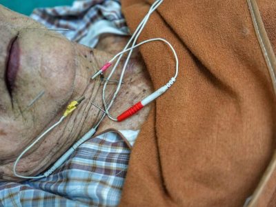 midsection-senior-patient-hospital_1048944-26216221